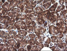 MAP2K1 / MKK1 / MEK1 Antibody (clone OTI2F12)