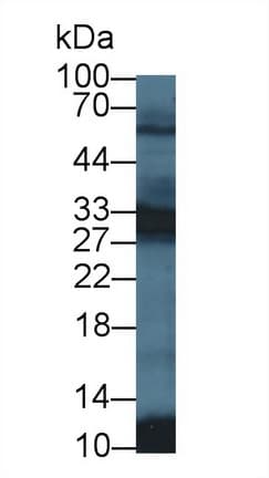 PGAM2 Antibody (aa1-236, FITC)