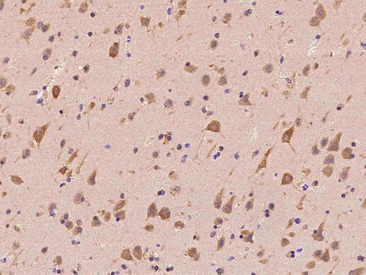 NAA10 / ARD1A Antibody (Preservative Free)