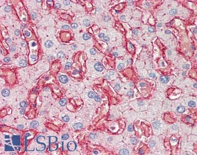 IHC-plus™ Polyclonal Rabbit anti-Human CD81 Antibody (Internal, IHC, WB)