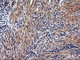NNMT Antibody (clone OTI1A1)