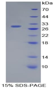 Mouse PODXL / Podocalyxin Protein (Recombinant His-T7)