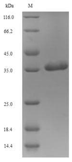 Human SLC34A2 / NaPi-2b Protein (Recombinant 6His-B2M, N-terminus)