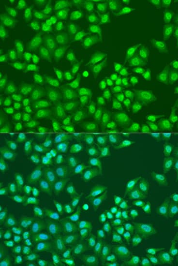 PTEN Antibody