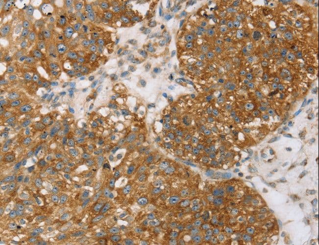 TPD52L2 / HD54 Antibody