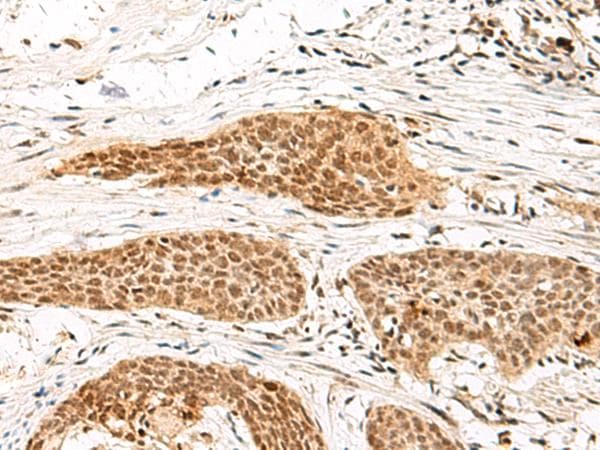 MDFI / I-MF Antibody