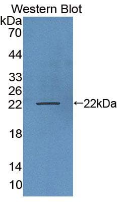 LAMP3 / CD208 Antibody (aa222-381)