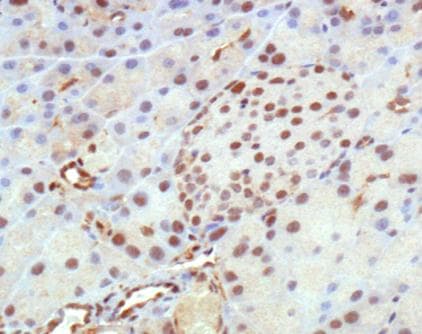 Polyclonal Rabbit anti-Human HDAC5 Antibody (aa1-100, IHC, IF, WB)