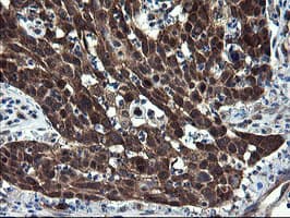 CNOT4 / CLONE243 Antibody (clone OTI1H2)