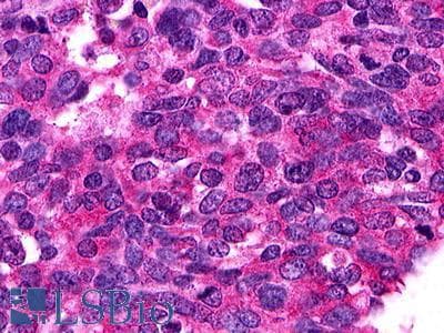 PathPlus™ Polyclonal Rabbit anti-Human S1PR1 / EDG1 / S1P1 Antibody (Cytoplasmic Domain, IHC)