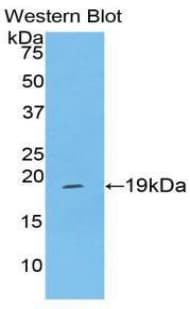F8 / FVIII / Factor VIII Antibody (aa2191-2337)