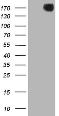 PDGFRA / PDGFR Alpha Antibody (aa789-1089, clone OTI1A11, Carrier-free)