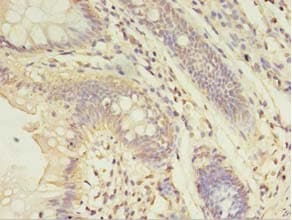 ABHD14A Antibody