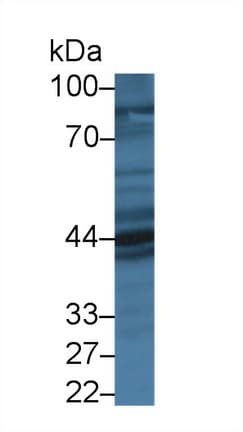 PRLR / Prolactin Receptor Antibody (aa20-229)