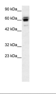 RLIM / RNF12 Antibody (aa532-581)