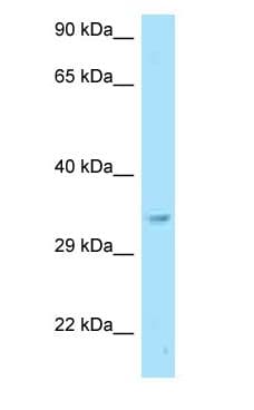 GNB2L1 / RACK1 Antibody (aa88-137)