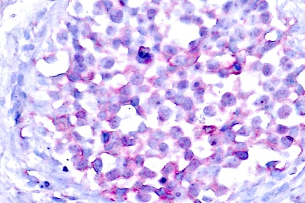 Polyclonal Rabbit anti-Human RAF1 / RAF Antibody (phospho-Ser259, IHC, WB)