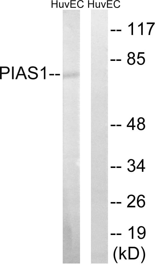 PIAS1 Antibody (aa10-59)