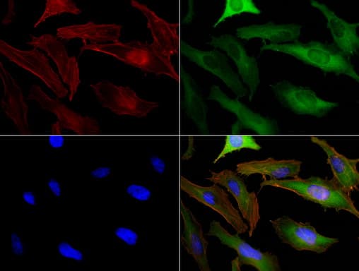BUB1B / BubR1 Antibody (clone UMAB7, Carrier-free)