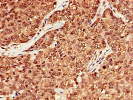 Polyclonal Rabbit anti-Human MRE11A / MRE11 Antibody (IHC, IF)