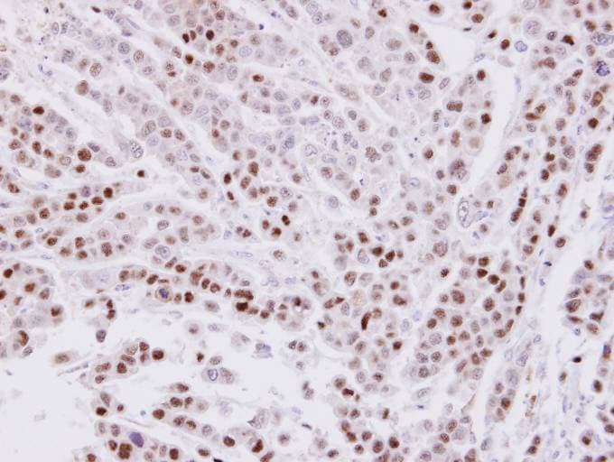 IHC-plus™ Polyclonal Rabbit anti-Human SARNP / Hcc-1 / CIP29 Antibody (aa4-210, IHC, IF, WB)