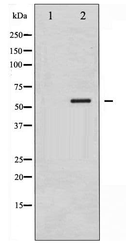 Polyclonal Rabbit anti-Human SMAD1 Antibody (phospho-Ser187, IHC, WB)