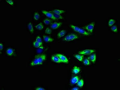 SLC26A8 / TAT1 Antibody
