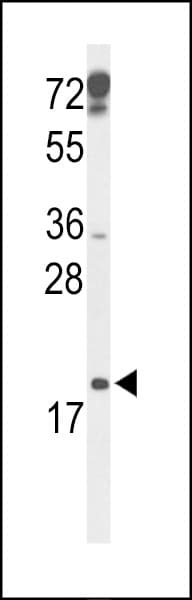IHC-plus™ CDKN2D / p19 INK4d Antibody (aa15-43)