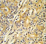 CYP51A1 / CYP51 Antibody (aa474-503)