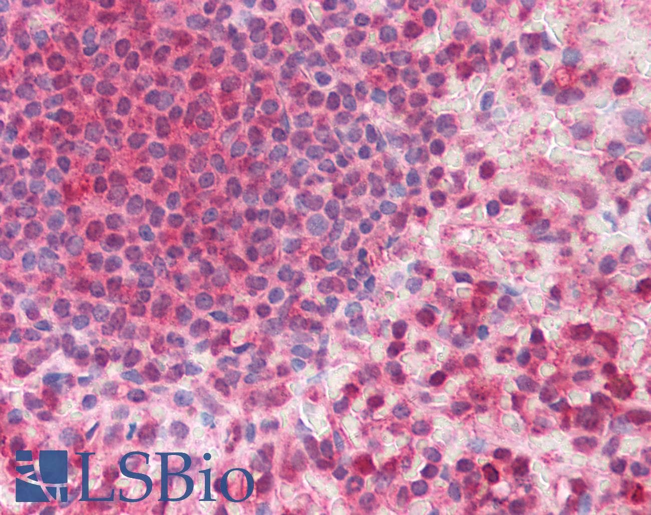 IHC-plus™ MMP16 Antibody (aa169-183)