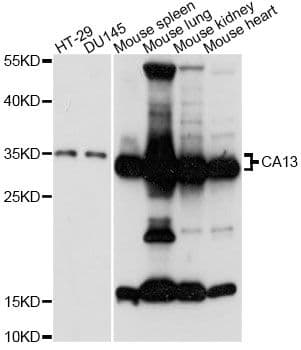 Polyclonal Rabbit anti-Human CA13 / Carbonic Anhydrase XIII Antibody (WB)