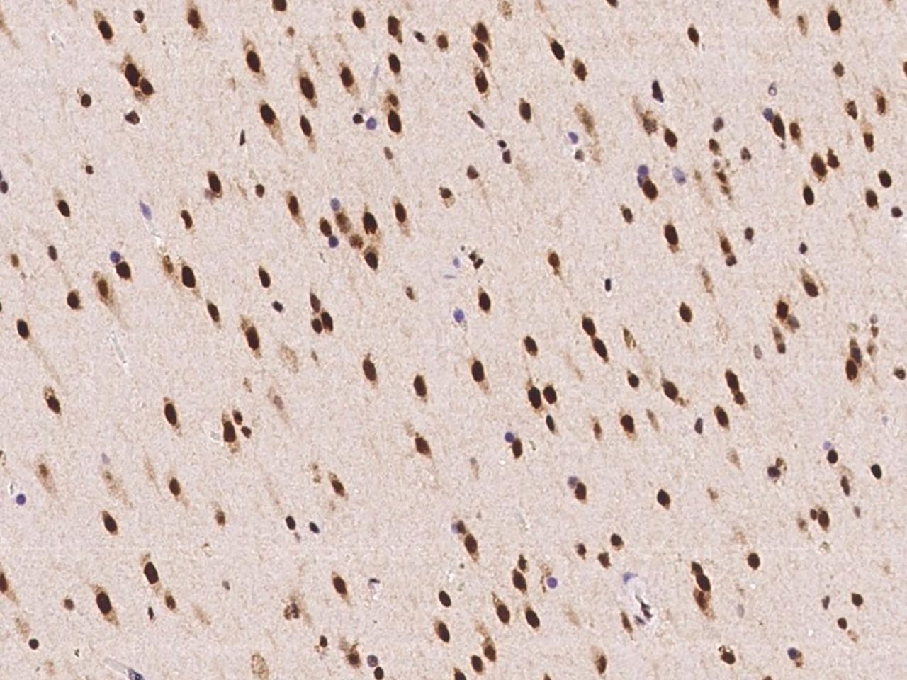 ACIN1 / Acinus Antibody