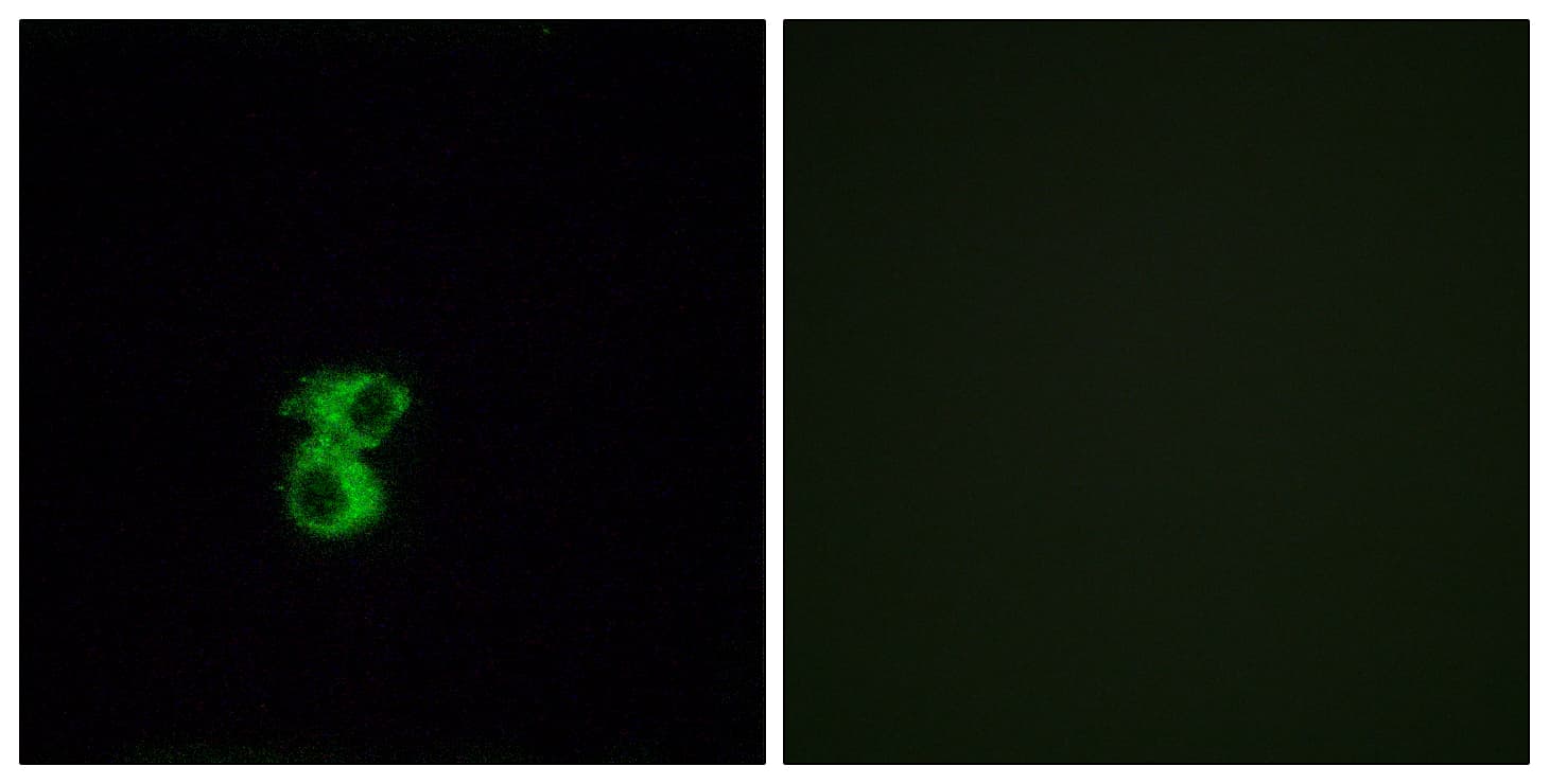 OR6B2 Antibody (aa261-310)