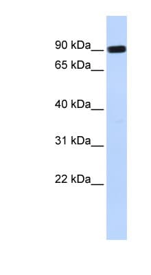 HECTD2 Antibody (aa648-697)