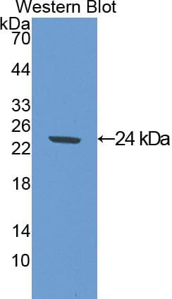 SOD2 / Mn SOD Antibody (aa25-222)