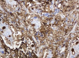 Monoclonal Mouse anti-Human EMA / MUC1 Antibody (clone OTI4A5, IHC, IF, WB)