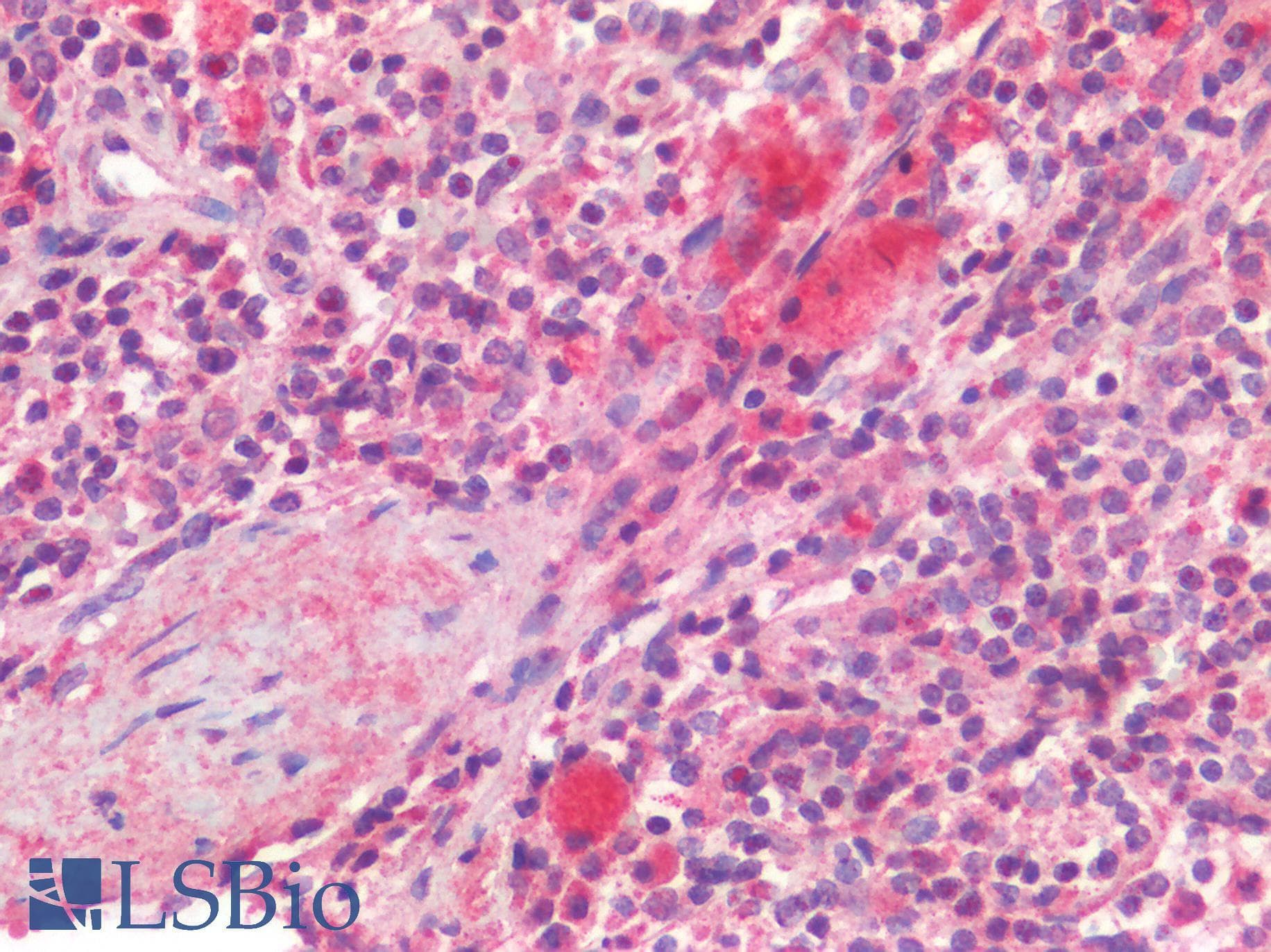 IHC-plus™ Polyclonal Rabbit anti-Human CD63 Antibody (IHC)