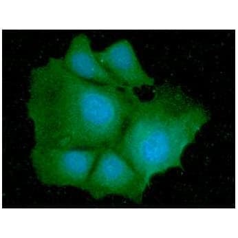 PathPlus™ IDH1 / IDH Antibody (clone AT25H10)
