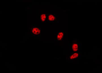 Polyclonal Rabbit anti-Human ZNF695 Antibody (IF, WB)