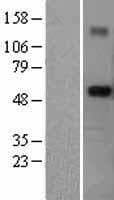 TRIM6 Protein (Over-Expression Lysate Myc-DDK (Flag))