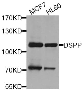Polyclonal Rabbit anti-Human DPP / DSPP Antibody (WB)