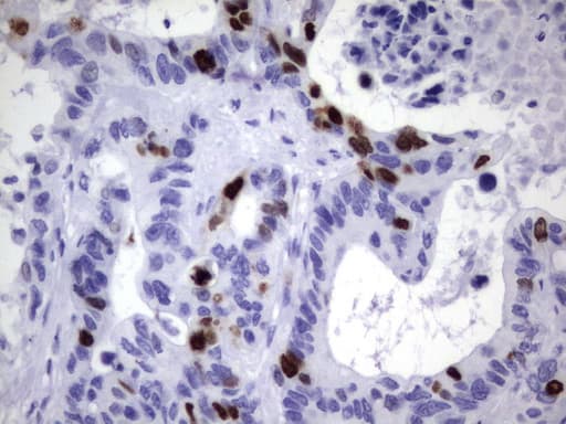 TOP2A / Topoisomerase II Alpha Antibody (aa1100-1531, clone UMAB145, Carrier-free)