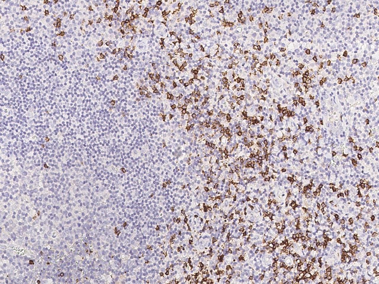 CD8A / CD8 Alpha Antibody (clone 38, Preservative Free)