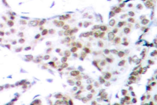 STAT3 Antibody (phospho-Ser727)