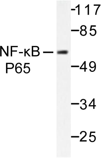 RELA / NFKB p65 Antibody (Met270)