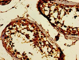 DKKL1 / Soggy-1 Antibody