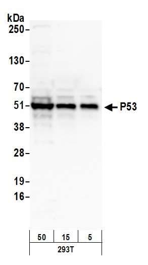 Polyclonal Rabbit anti-Human TP53 / p53 Antibody (aa50-100, IHC, WB)