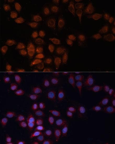 ADAM15 Antibody