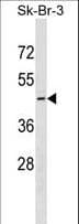 QTRT1 Antibody (aa345-371)