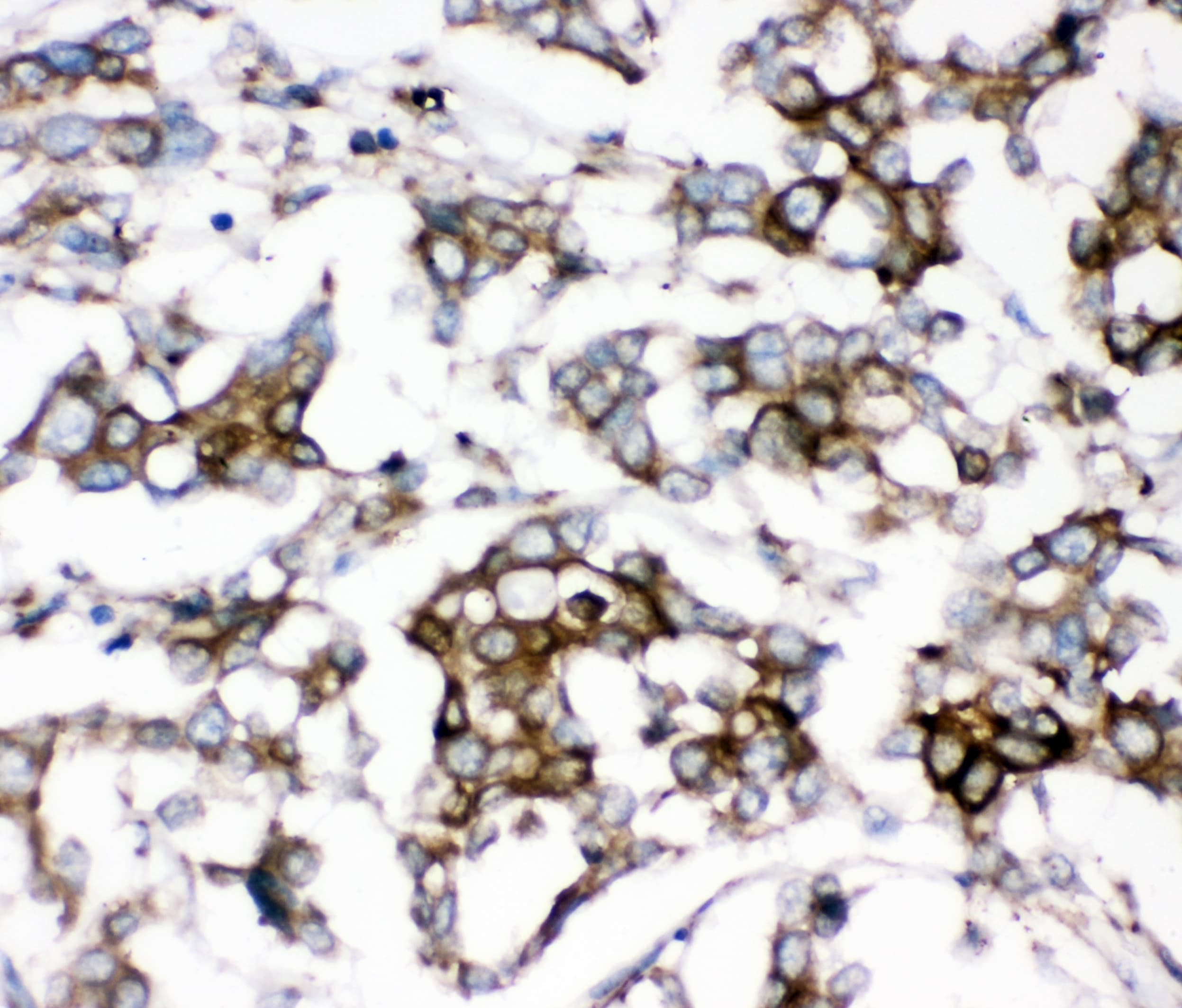 AEBP2 Antibody
